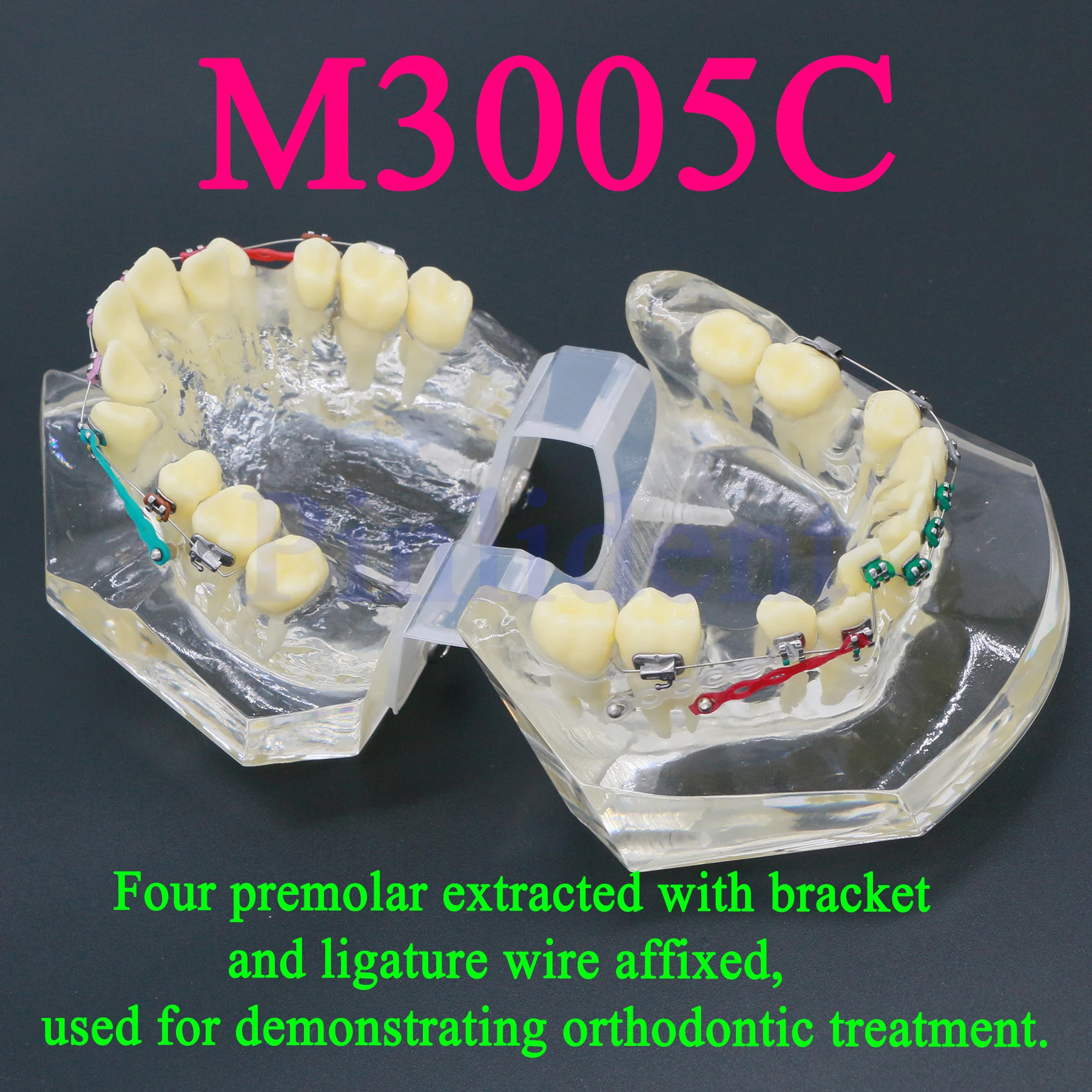 Orthodontic Teeth 1:1 Standard Demonstration Model Demonstration of Treatment Procedure Orthodontic Braces Dental Supplies