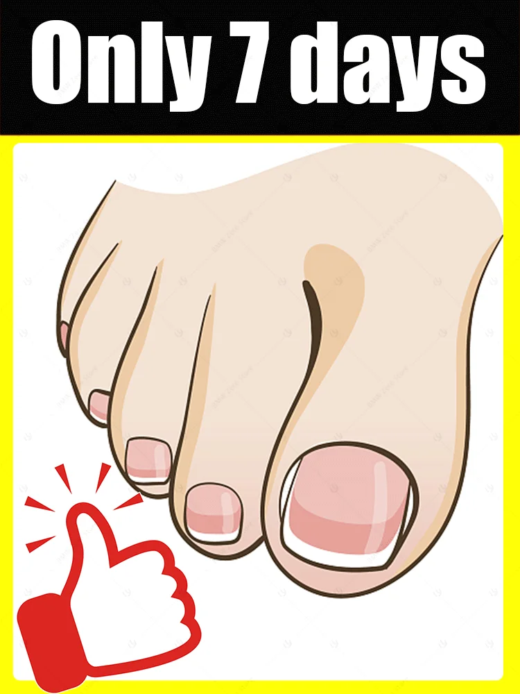 

manicure for bad Can in 7 days farewell
