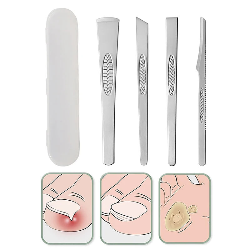 3/4PCS Pedicure Tools Professional Set Kit Feet Knife Kit Set Dead Skin Remover Ingrown Toenail Pedicure For Feet Tools