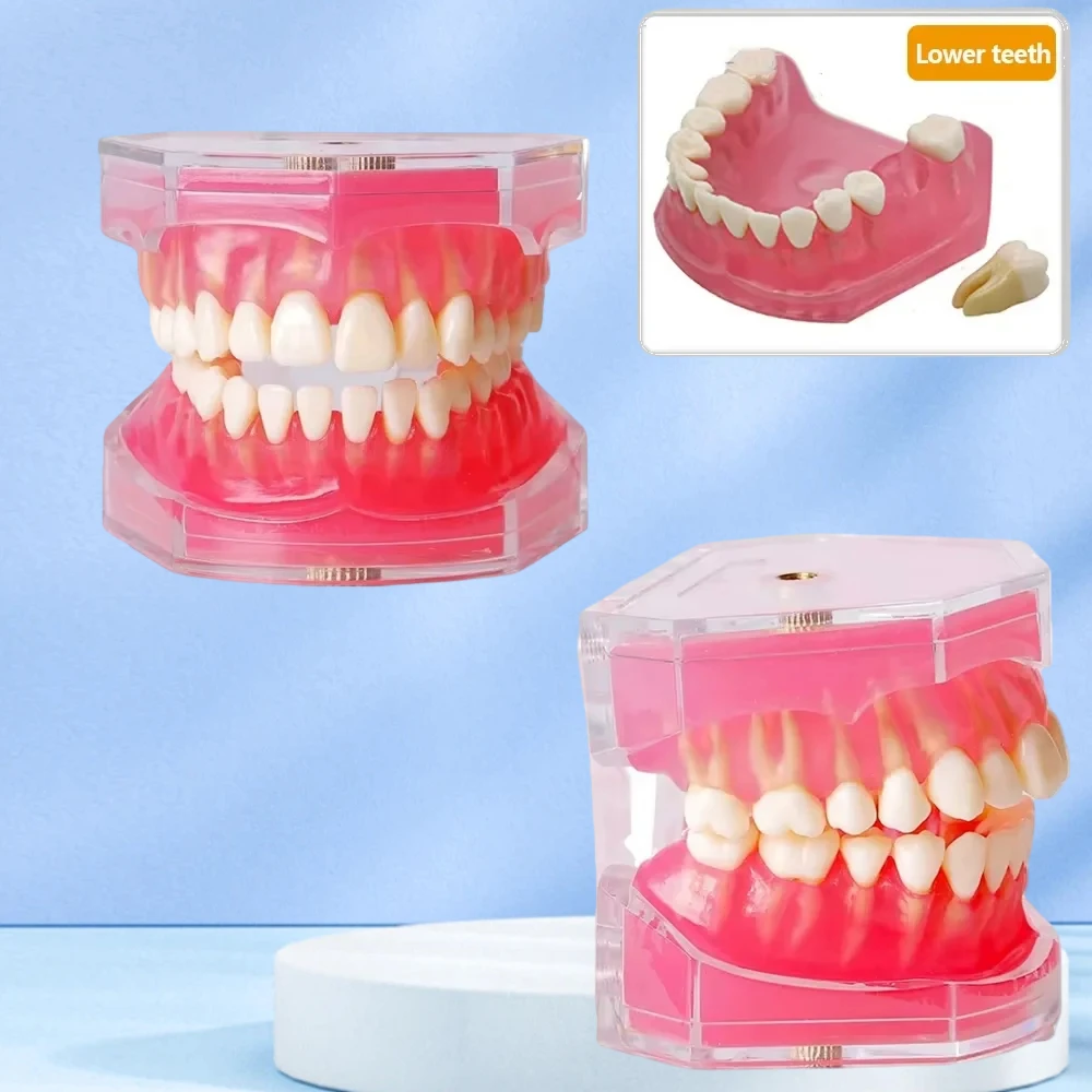 

28 зубьев, обучающая модель зубного имплантата со съемными зубьями, стандартная модель челюсти Typodont, мягкая резинка, демонстрационные модели для стоматологической лаборатории