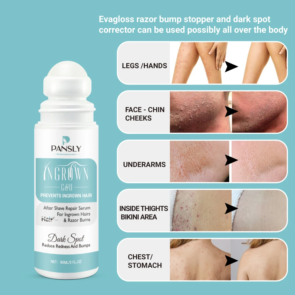 100ml Ingrown Hairs Treatment After Shave Repair Dark Spot Serum Hair Growth Removal Inhibitor Painless Bikini Legs Smooths Skin