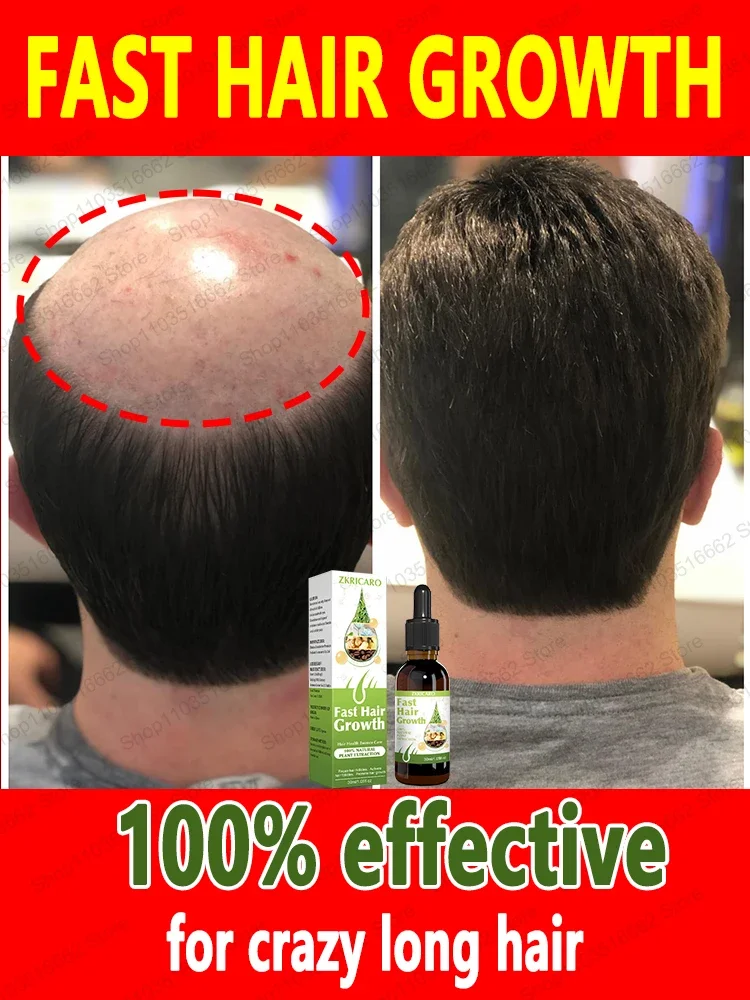 99% of buyers buy again, have more and more hair, say goodbye to baldness, thick hair,Hot selling product