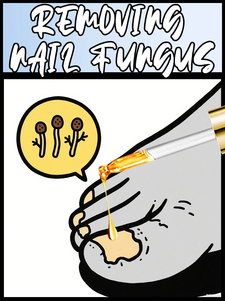 

Tea Tree Nail Treatment, Blue Laser, Daily Foot Care, 10ml