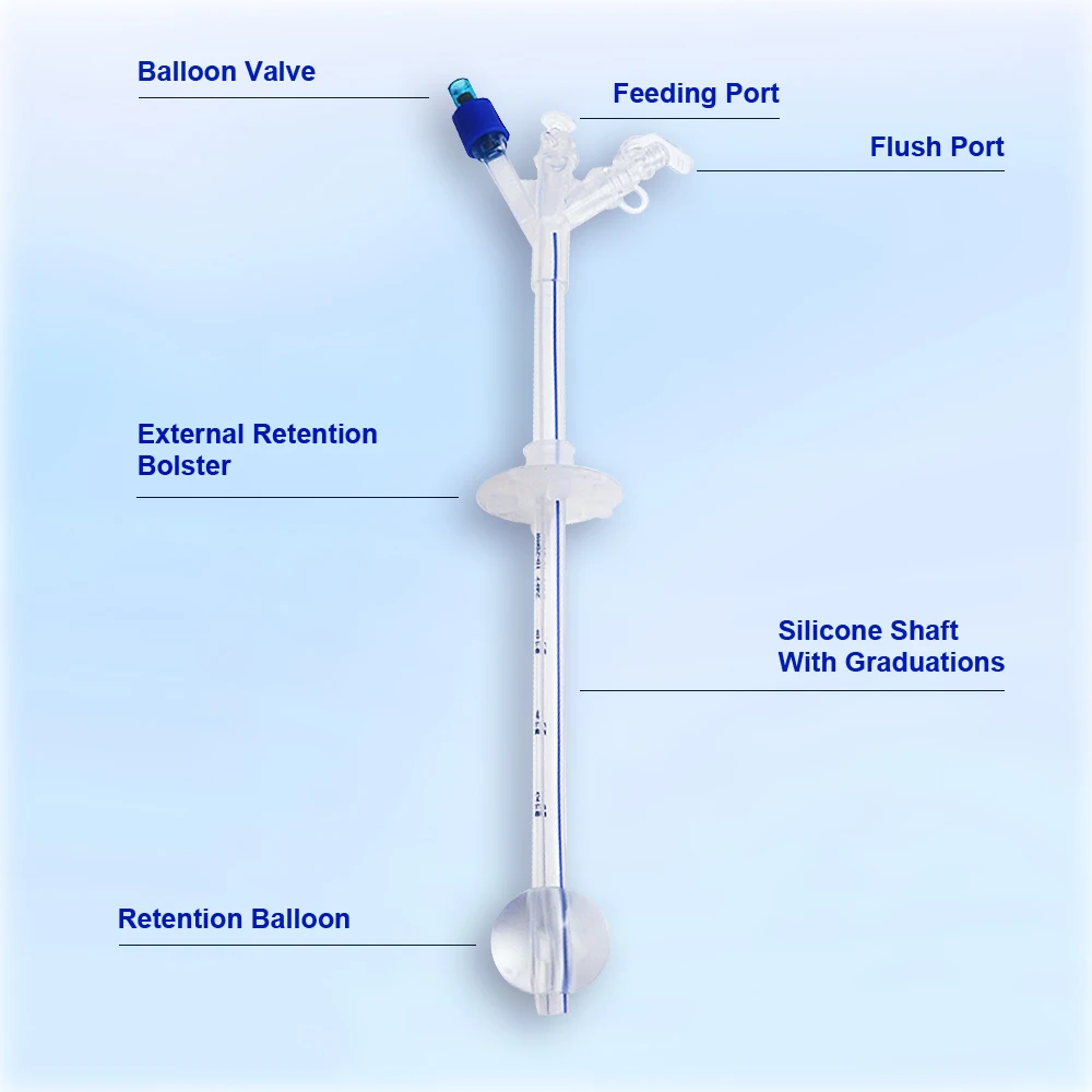 Califed Silicone Gastrostomy Tube Multi Functional Connector X-Ray Medical PEG Tube With Balloon Gastrostomy Surgical Equipment