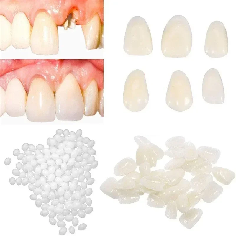 

50PCs Dental Crowns Teeth Veneers Temporary Crown Front Molar Missing Repair Anterior PosteriorDentistry Tooth Whitening Tools