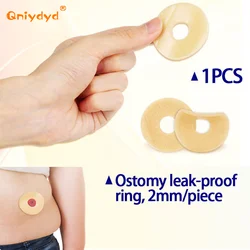 1pc Ostomy Paste Ring Baseplates Stoma Care Leak-Proof Ring For Ostomy Bag