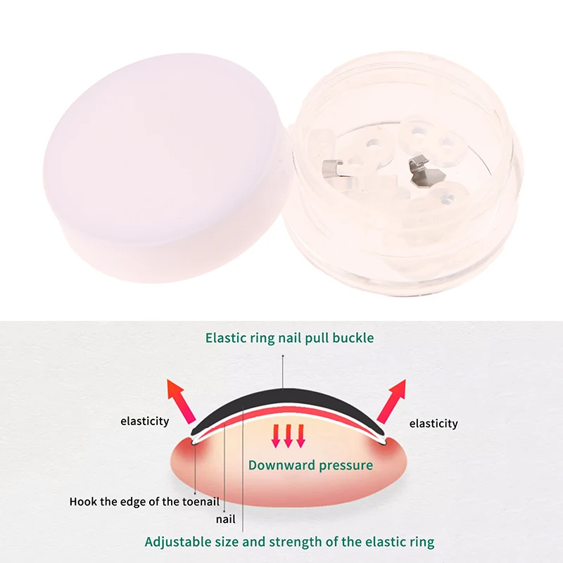 (.) Ingrown Toenail Corrector Tools Pedicure Recover Embed Toenail Treatment Professional Foot Care Correction Tool 1Set