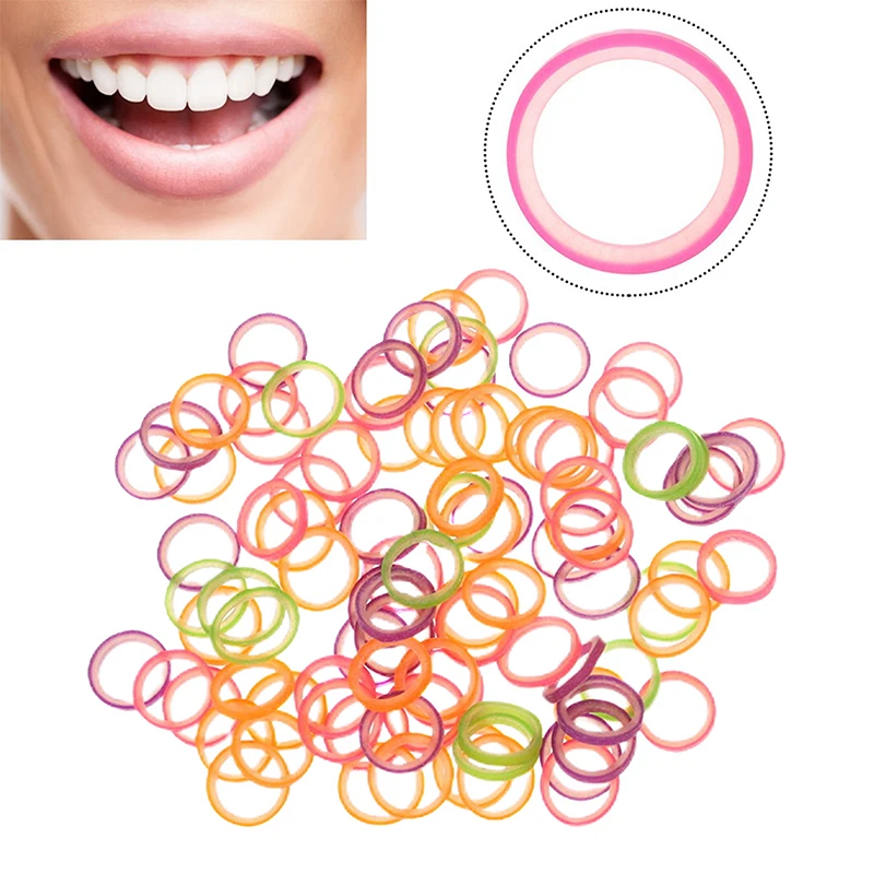 100Pcs Elastic Rubber Teeth Traction Rings Orthodontics Rubber Band Mixed Dentist Tools Dental Laboratory Dentistry Accessories