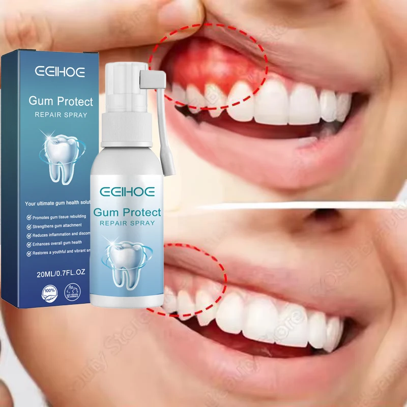 Damaged Gum Repair Care Spray Relieve Sore Gums Allergy Deep Cleaning Teeth Stains Tartar Serum Dental Caries Toothpaste