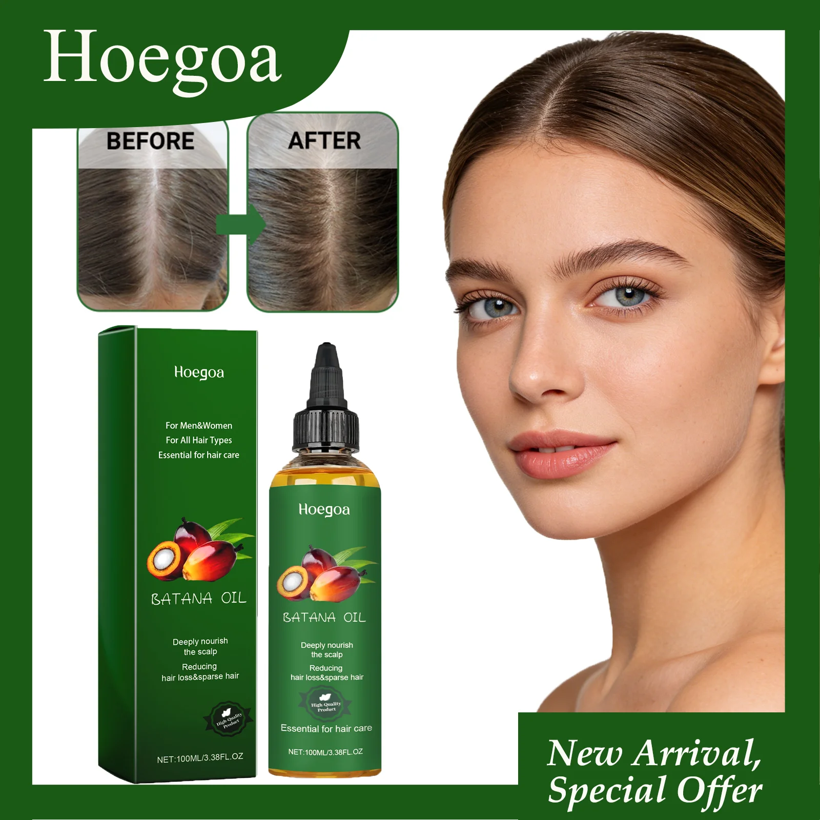 hoegoa-100ml-バタナオイルは、髪の成長を促進し、頭皮に栄養を与え、毛包を刺激します。成分は低刺激性のヘアオイルです。