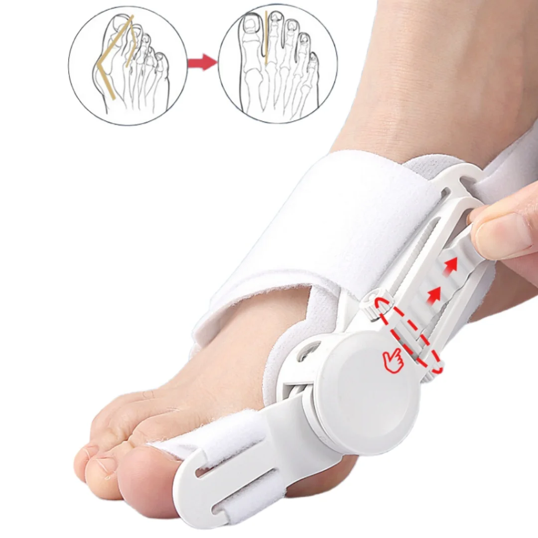 Adjustable Hallux Valgus Corrector Knob Buckle Bunion Corrector Bunion Splint Big Toe Straightener Overlapping Toe Separator