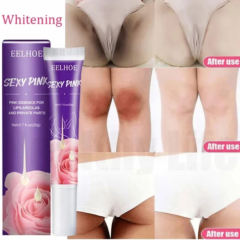 Brightening Cream For Intimate Parts Body Knees Remove Dull Pigments Brighten Serum Elbows Knuckles Lightening Skin Care Product