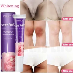 Creme de clareamento para partes íntimas, joelhos corporais, remover pigmentos maçantes, iluminar soro, cotovelos, juntas, produtos de cuidados com a pele