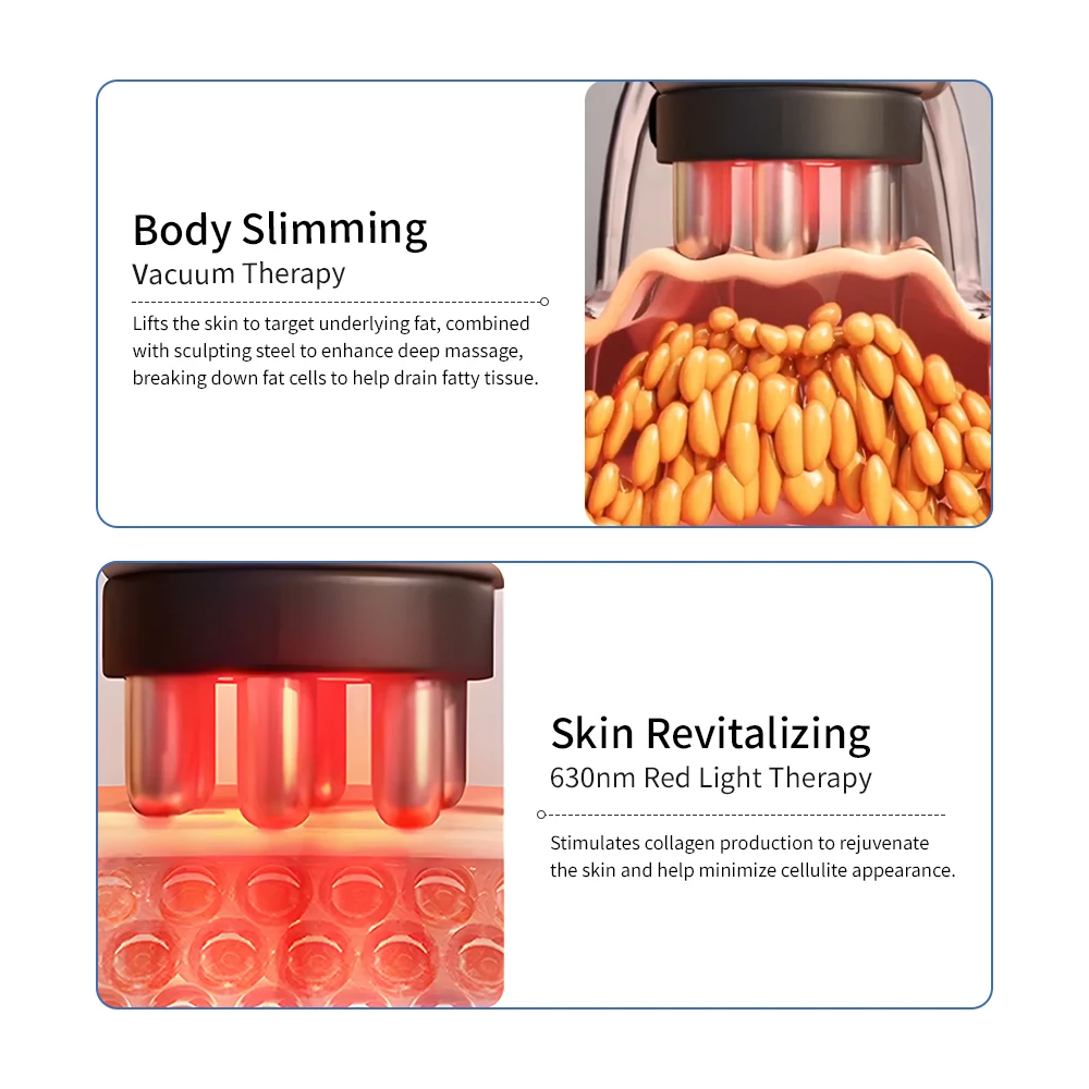 Therapie Elektrische Cupping Massager Met Rood Licht Cellulite Remover Body Sculpting Machine Draagbare Body Slimming Massager