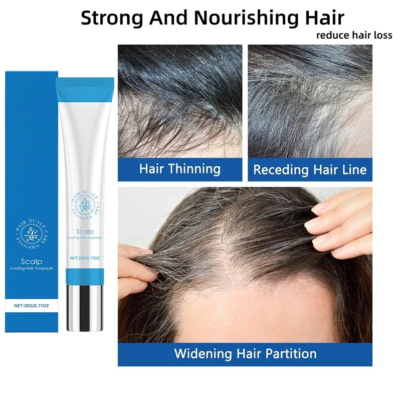 

Scalp Treatment Roller Ball Serum Prevents Hair Loss Intensive Nourishing Promotes Hair Growth Hot-selling Brand Scalp Treatment
