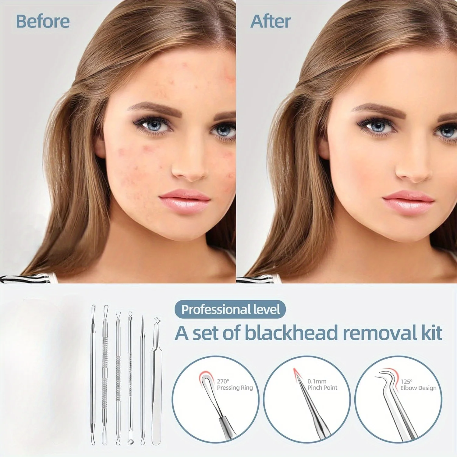 Ferramenta de remoção de cravo extrator de acne kit de limpeza de acne, adequado para manchas, bursts de buraco branco, ferramentas de nariz e rosto caixa de ferro