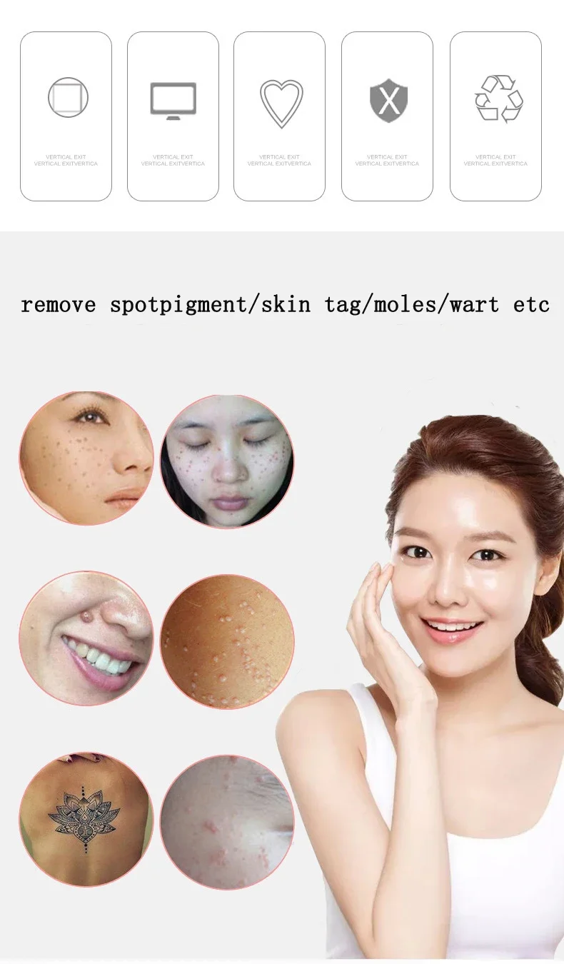 Removing nevi, spot nevi, spot scanning machine, beauty nevi pen, scanning pen, removal instrument, beauty