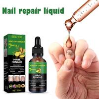 NEW High-end 50ML Nail Fungal Treatment Feet Care Essence Anti-infective Repair Paronychia Oil Onycho Feet Toenail Essence A7W5