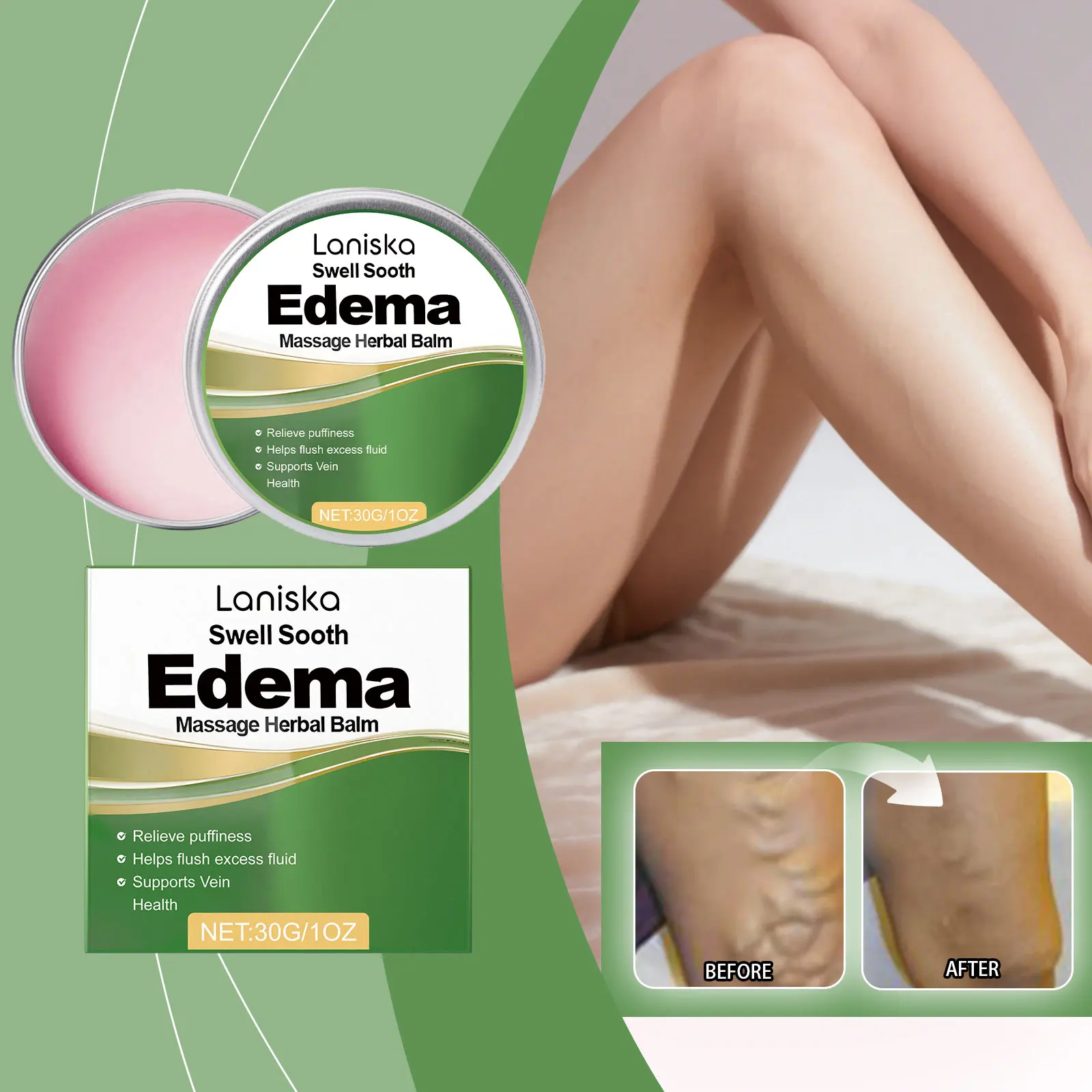 Varicose Vein Treatment Cream Effective Remove Spider Veins Prevent Capillary Dilation Improve Leg Fatigue Edema Soothing Balm