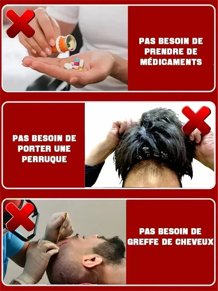 El cabello nutre el cuero cabelludo peso ligero no graso mejora la circulación del cuero cabelludo crecimiento del cabello pérdida esencial tratamiento de crecimiento fortalece