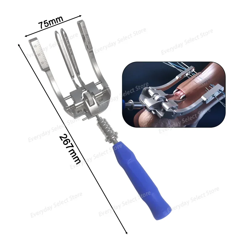 Stainless‑Steel Pet Achilles Tendon Reduction Instrument, Veterinary Orthopedic Manipulation Tool