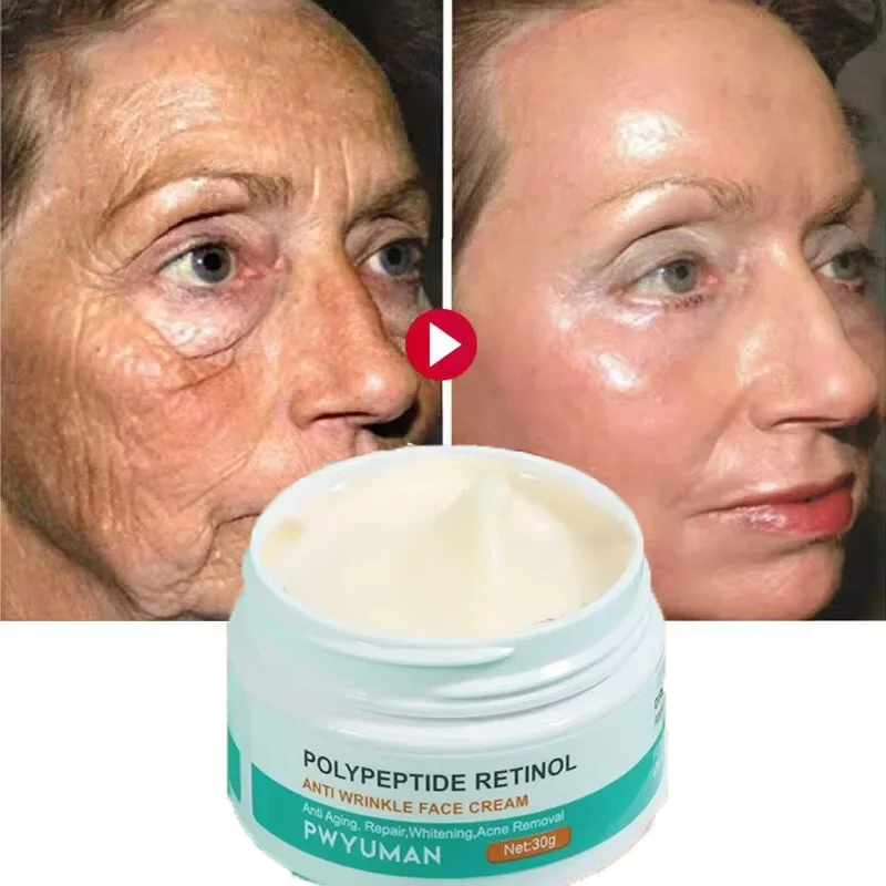 Retinol Remove Wrinkles Face Cream Anti-Aging Lifting Firming Fade Fine Lines Improve Dullness Whitening Moisturizing Skin Care