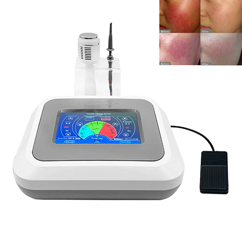 60W RF Vaso sanguigno rosso Rimozione vascolare Detergente per il viso Macchina di bellezza Ago ad alta frequenza Rimozione vene del ragno Strumento per la cura della pelle