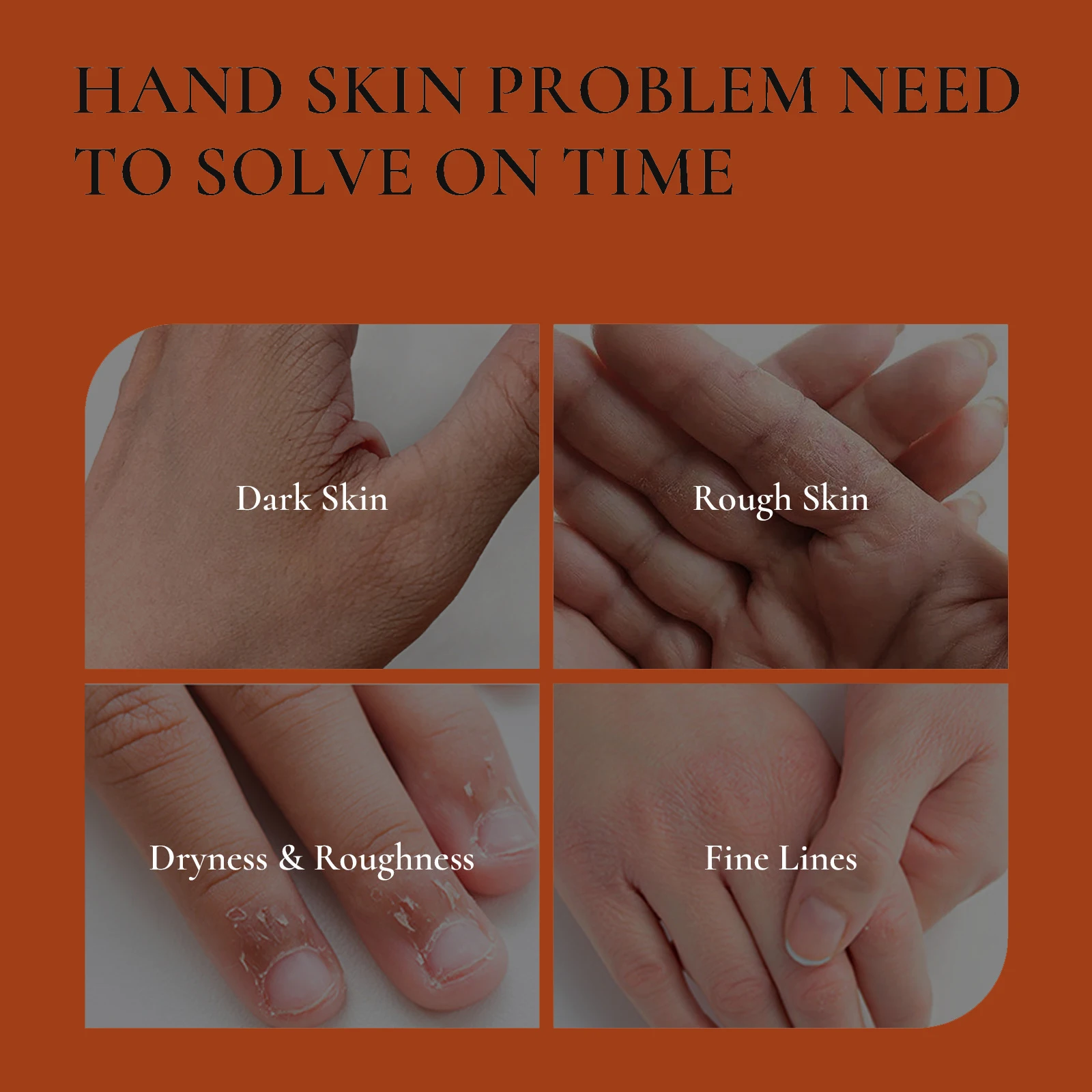Thumbnail 4 - #2 Latest Hand Care Updates