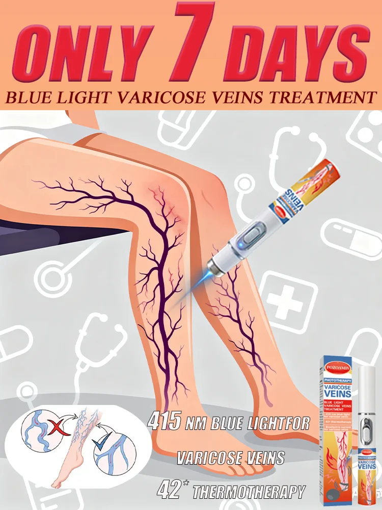 

Vᴀʀɪᴄᴏsᴇ ᴠᴇɪɴ ʟᴀsᴇʀ ᴛʀᴇᴀᴛᴍᴇɴᴛ, advanced equipment, painless spider vein treatment