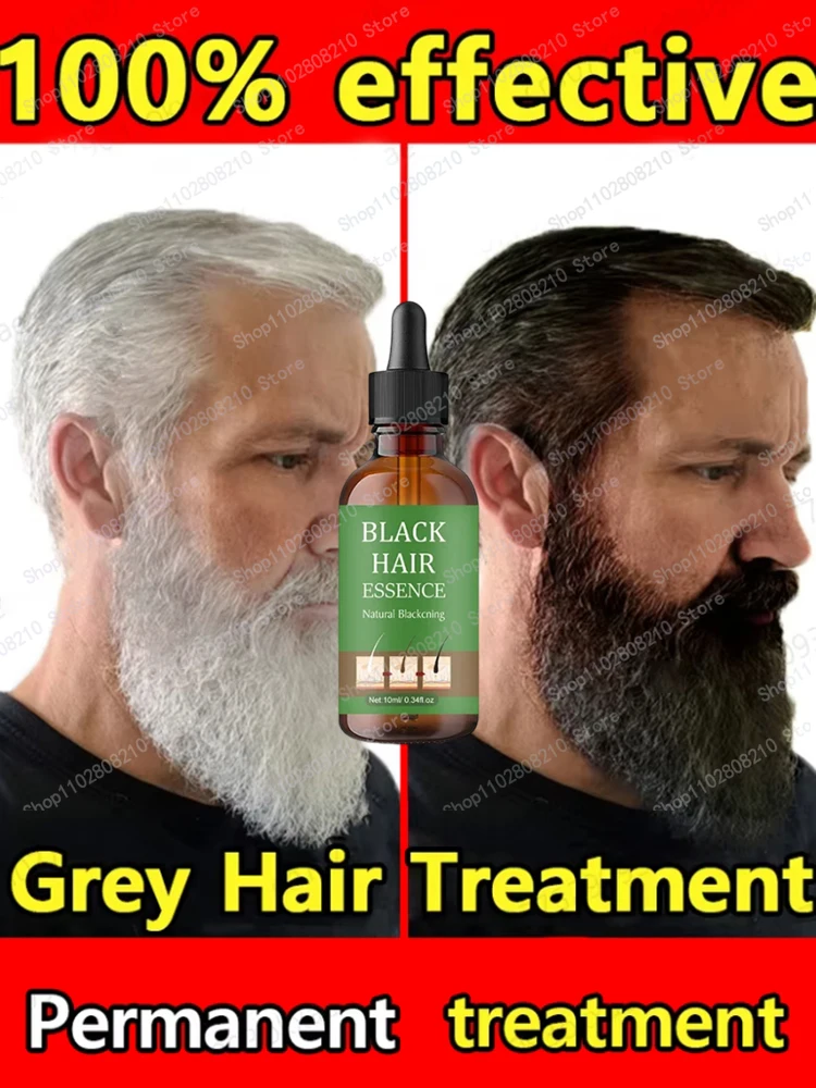 Health with Anti-Grey Hair Essence Serum Treatment Revitalize Your Ahair Essence Serum Treatment Restore Natural Hairand 23 0903