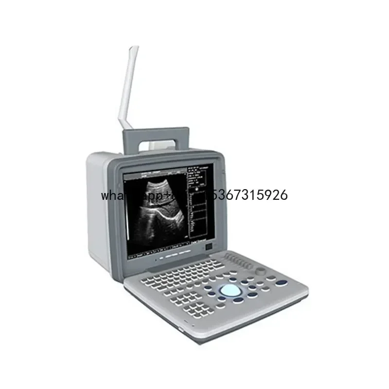 Factory Direct 4d Color Doppler Ultrasonic Portable