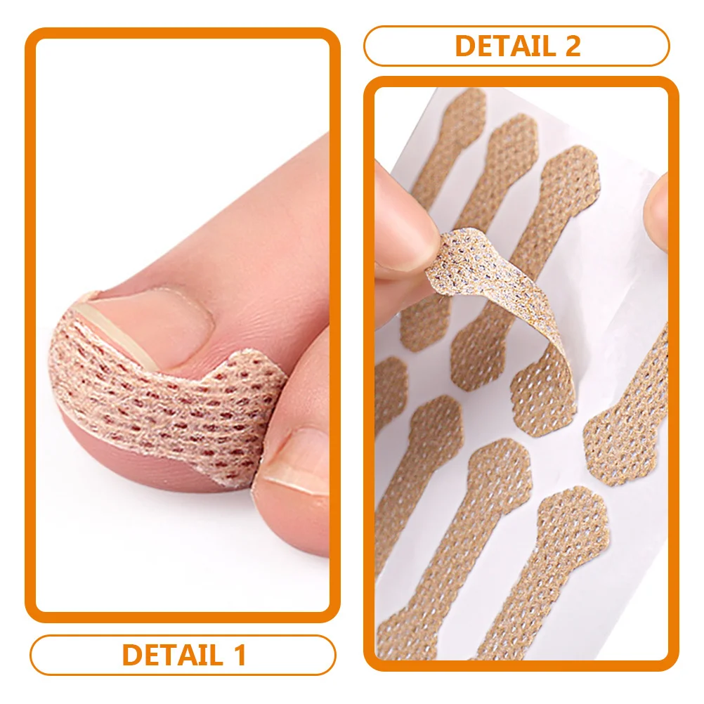 8 枚の整形外科用足の爪矯正パッチ陥入爪矯正ストリップポータブルフットケアツール爪矯正ストリップ