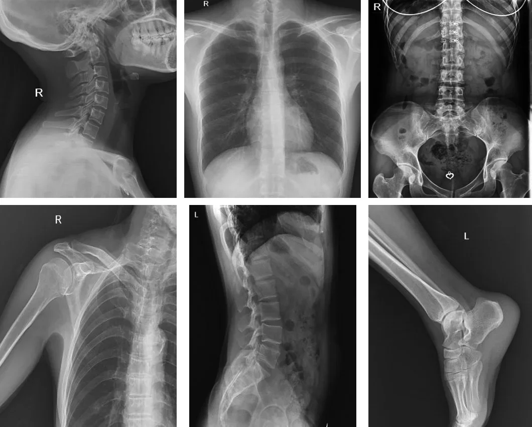 Veterinary X-ray For Pet Animal Portable Veterinary X Ray Equipment Vet X-ray Machine