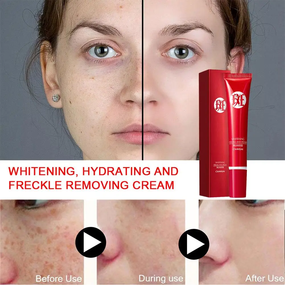 

Nicotinamide Whitening Freckle Cream Remove Melasma Moisturizing Skin Rejuvenation Nourishing Dark Care Lightening Spots W6C5
