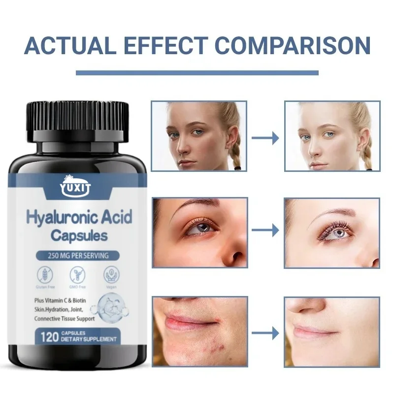 Hyaluronic Acid Capsules with Biotin & Vitamin C Improve Rough Skin Care, Joint Lubrication