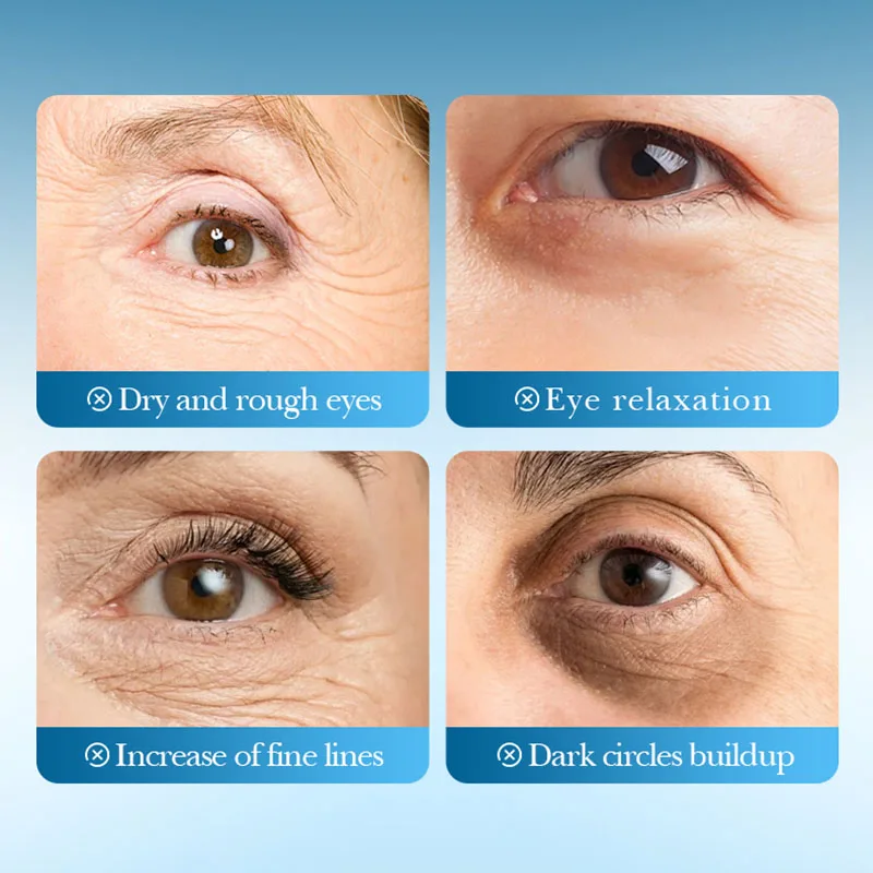 Thumbnail 3 - #14 Trending Eye Masks Right Now