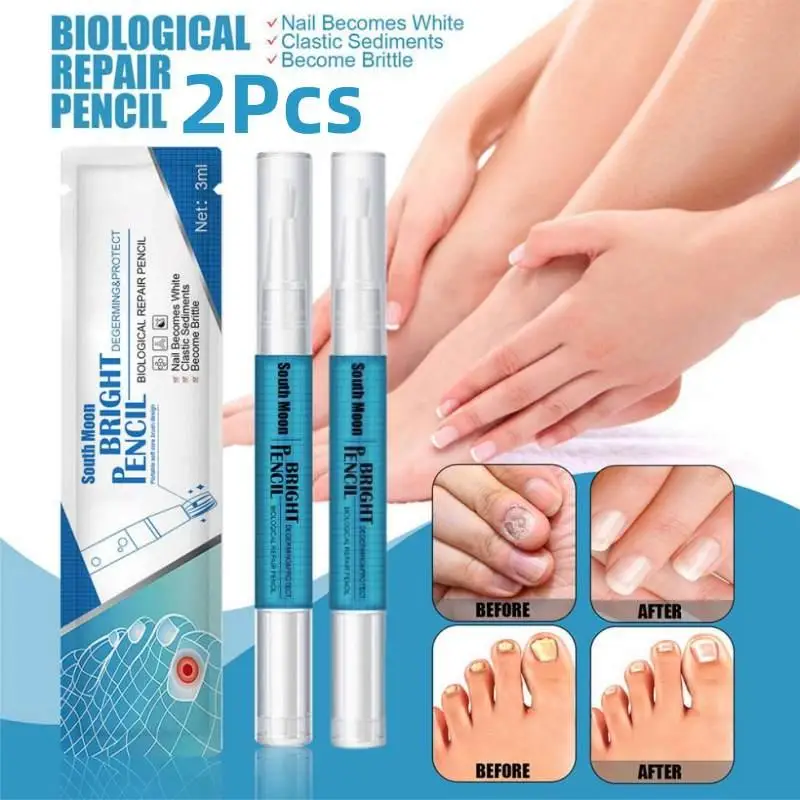 Caneta líquida para reparo de unhas, 2 peças, tratamento de fungos nas unhas, soro, creme para os dedos dos pés, gel anti-remoção, reparação de fungos nos pés, infecção líquida