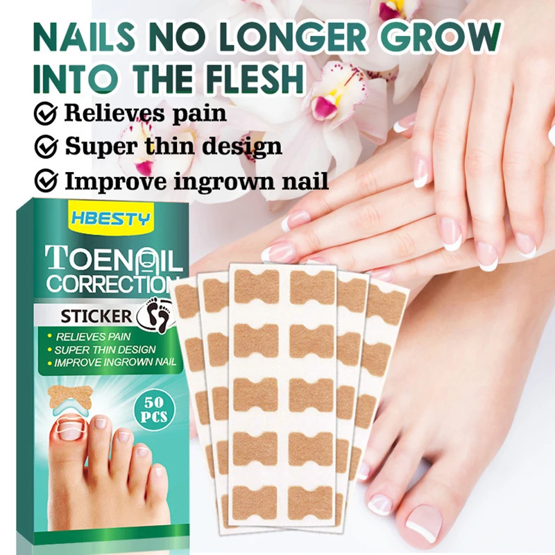 50Pcs Ingrown Nail Correction Stickers Paronychia Treatment Recover Corrector Pedicure Tool Nail Correction Care Stickers