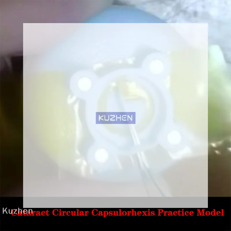 

Модель для практики кругового фоноскопического куполообразного разреза капсулорексиса (2.0/3.0, 1 метр) для офтальмологии