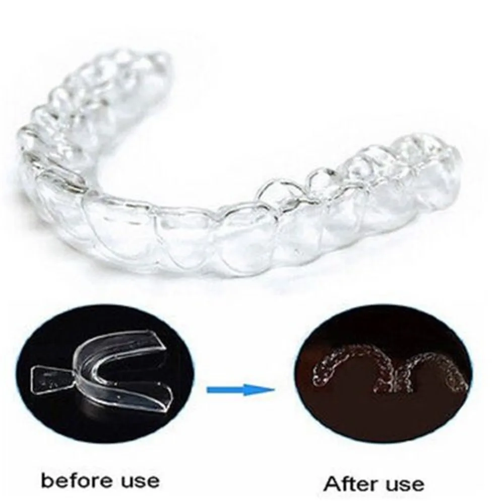 Thumbnail 2 - #18 Low Cost Dental Mouthguards That Work