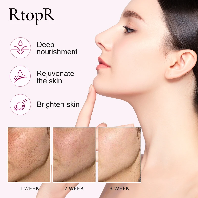 ビタミンCカタツムリエッセンス,アンチエイジング,しわ防止,毛穴の美白,保湿,オイルコントロール,フェイスケア