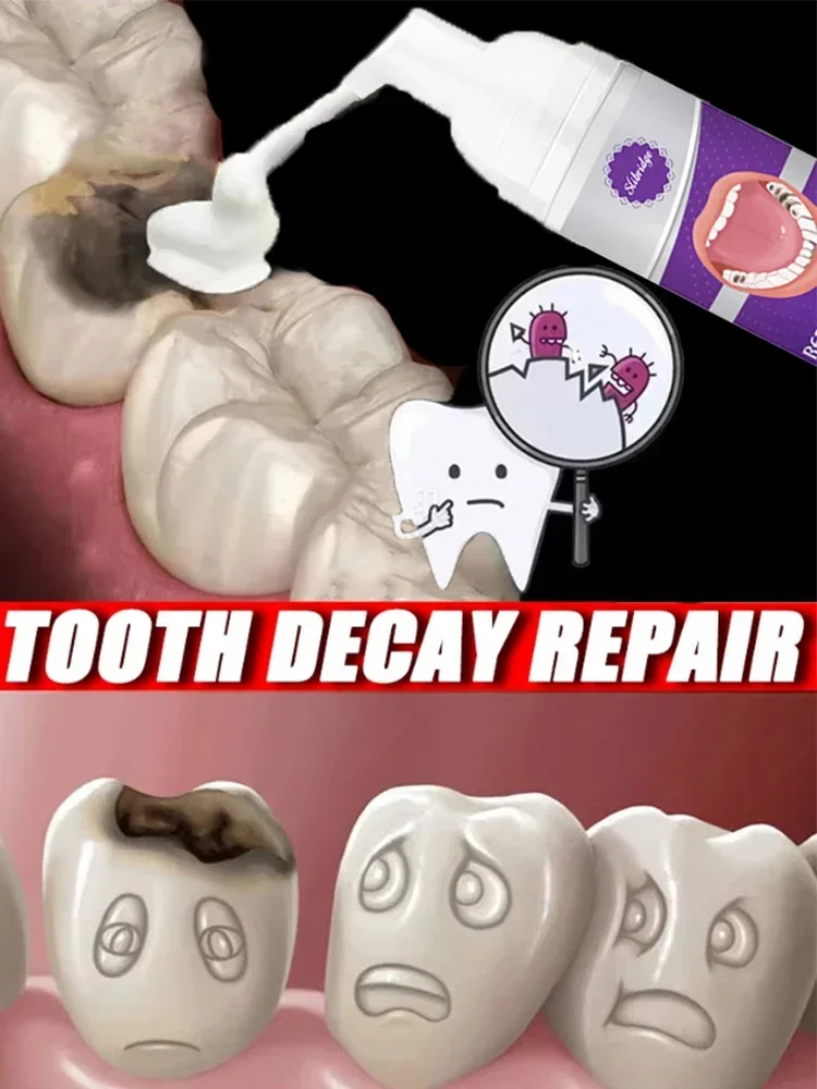 

Anti-Cavity Repair Tooth Decay