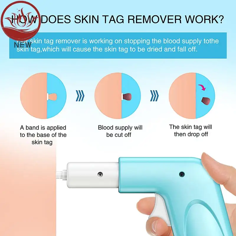 1Set 3 In 1 Auto Skin Tag Remover Painless Mole Wart Removal Kit Device Professional Face Care Beauty Tool Home Use