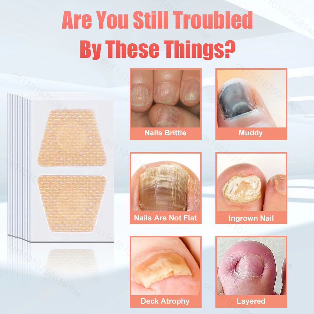 Parches de reparación de uñas, pegatinas transpirables para tratamiento de uñas de paroniquia, Corrector de uñas encarnadas adhesivo impermeable, parche de hongo