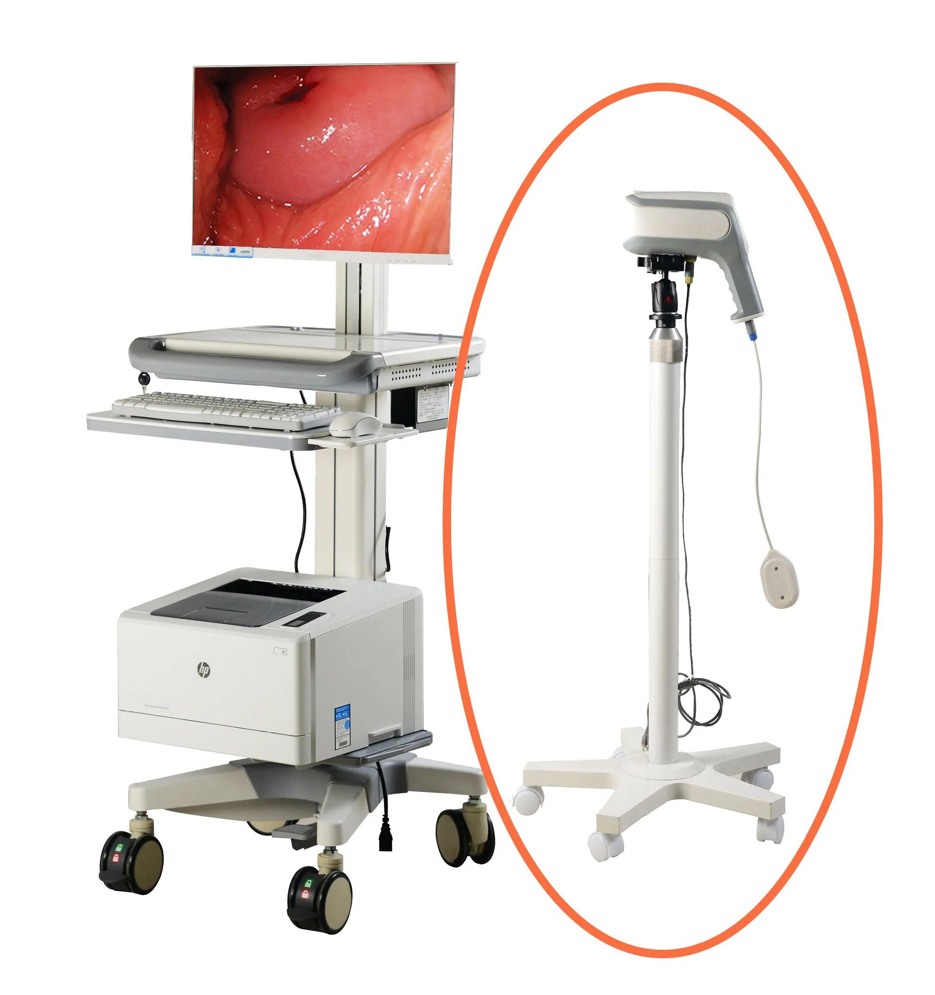 Vagina colposcopy accessories digital Video Colposcope with  camera