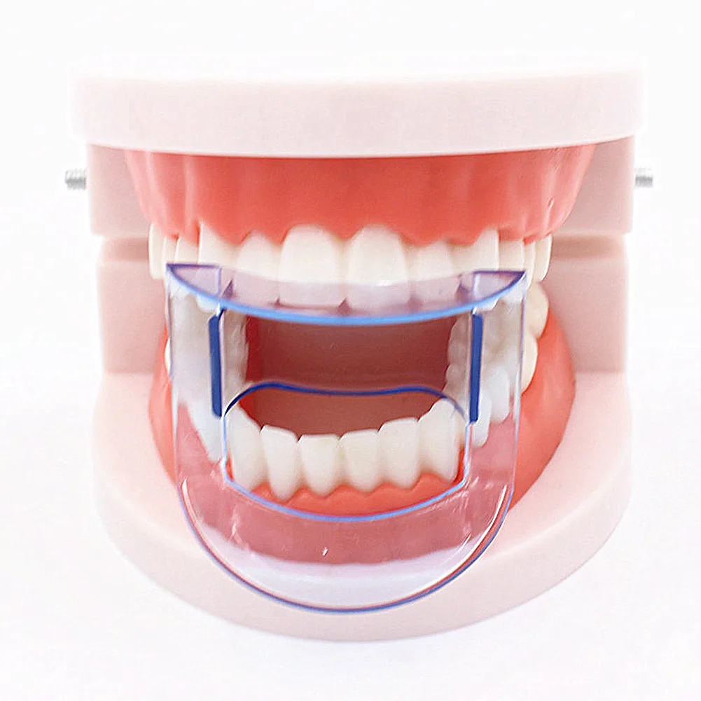 Tandheelkundige Mondopener Intraorale Wang Retractor Bijtgereedschap Open Mond Gag Dam Frame Voor Anterieure Posterieure Tandheelkundige Materialen