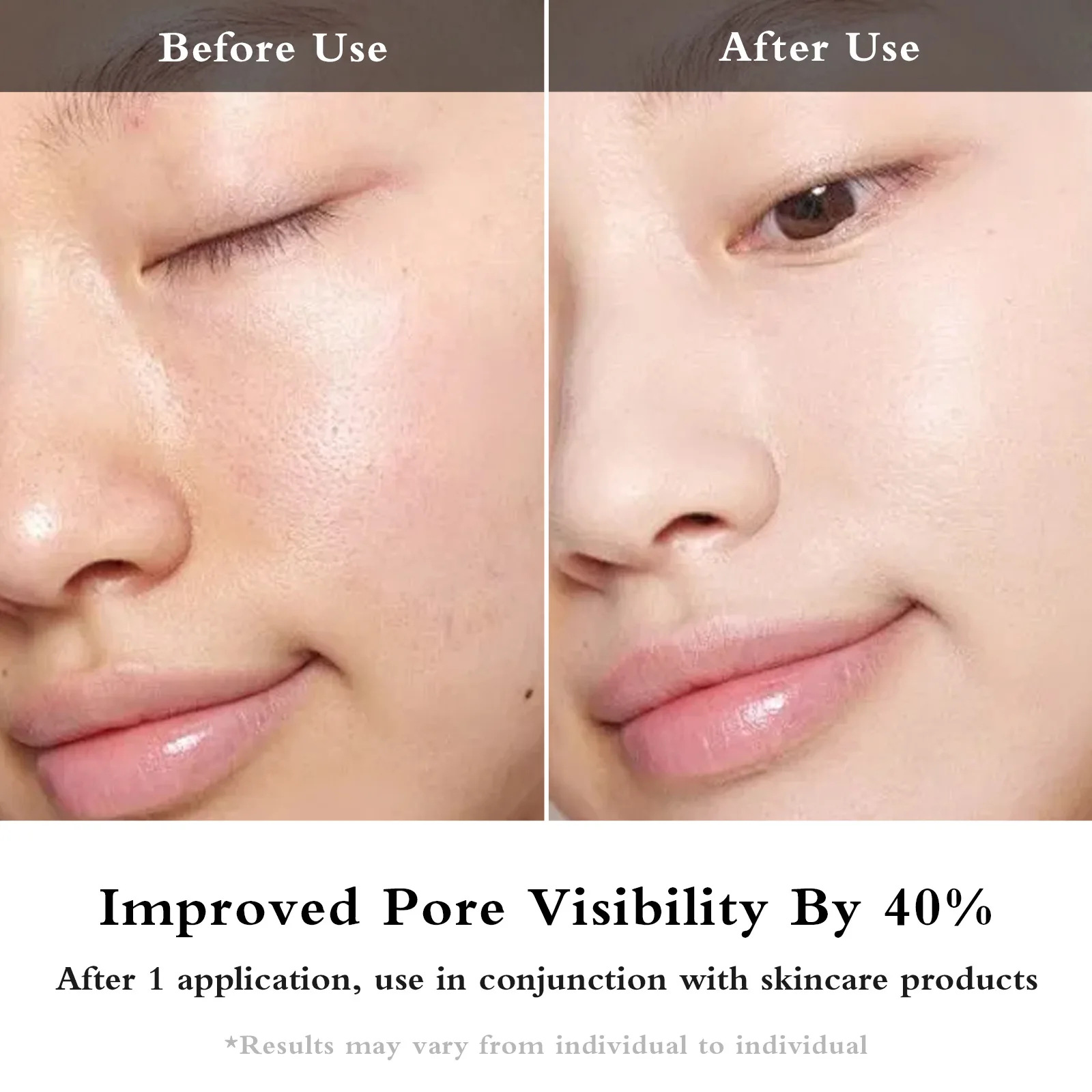 Dispositivo de belleza de infusión EMS Facial, masajeador Facial para rejuvenecimiento de la piel IPL, dispositivo de rejuvenecimiento de ojos