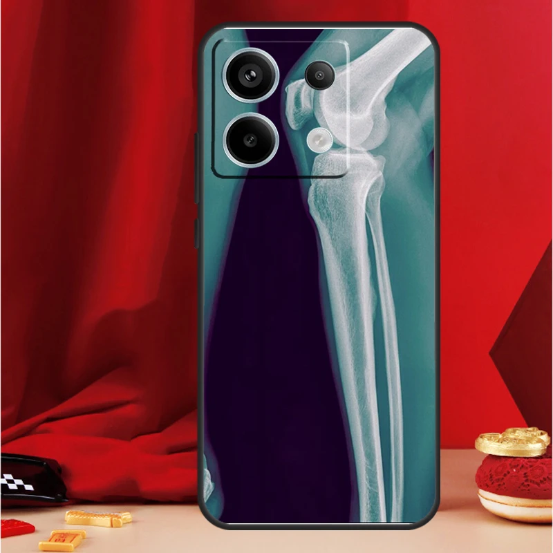 X-Ray 인체 해부학 케이스 Xiaomi Redmi Note 11 12 13 Pro 8 9 10 Note 12S 11S 10S 9S Redmi 13C 10C 12C 커버