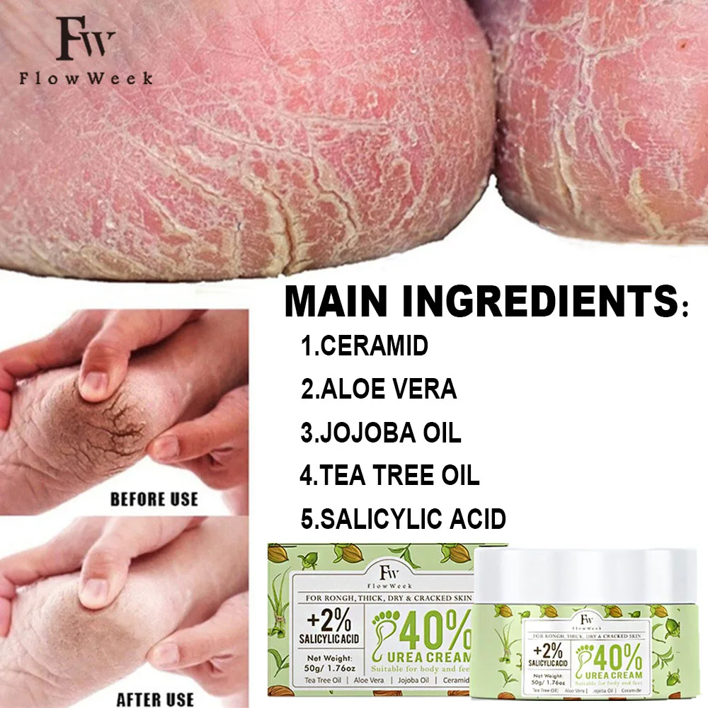 50g Anti Crack Foot Cream Anti-Drying Heel Cracked Repair Calluses Dead Skin Removal Moisturizing Hand Feet Care Beauty Health