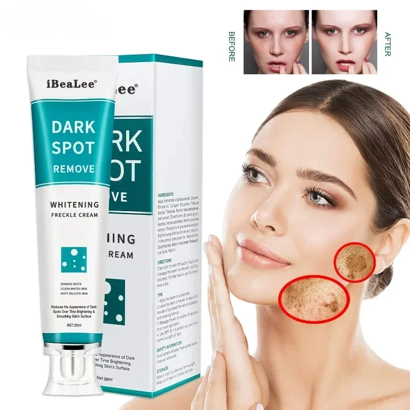 Whitening Freckle Cream Remove Dark Spots Remove Melasma Anti Freckle Cream Fade Pigmentation Anti-Aging Light Skin Care